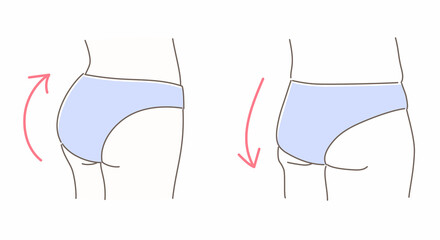 40代~50代の加齢に伴うヒップの変化